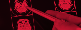 traumatic-brain-injury-xray-red